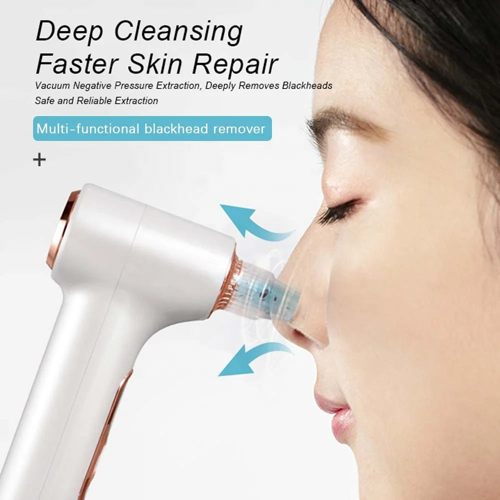 Facial Acne Vacuum Pore Cleaner Blackhead Removal Spot Cleansing Skin Home Spa
