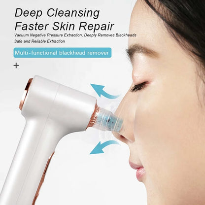 Facial Acne Vacuum Pore Cleaner Blackhead Removal Spot Cleansing Skin Home Spa